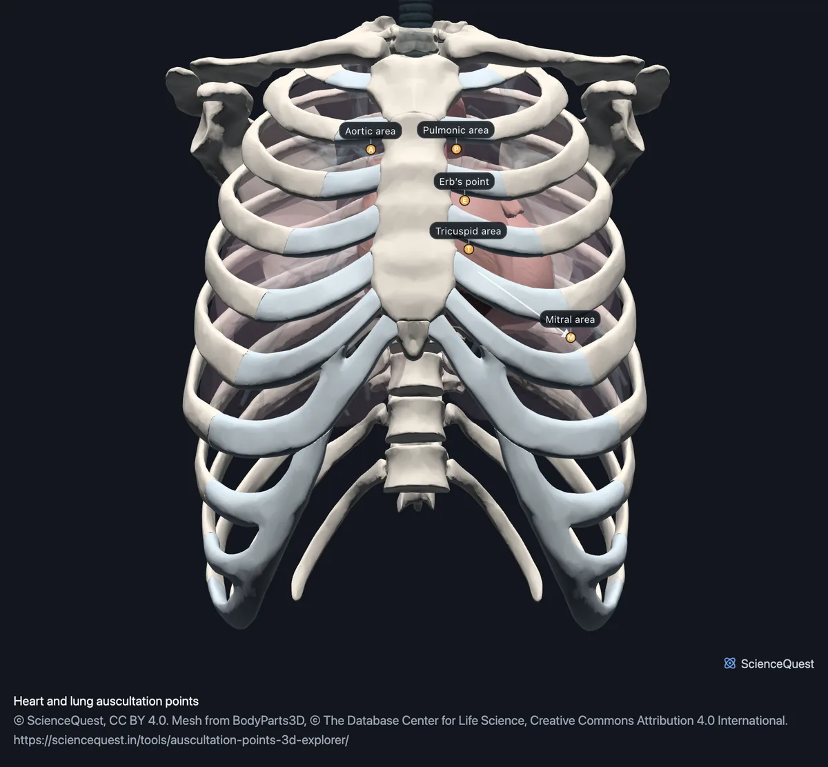 The rib cage from the front over glass lungs and the heart, with lettered pins on the ribs at the aortic, pulmonic, Erb’s point, tricuspid and mitral areas.