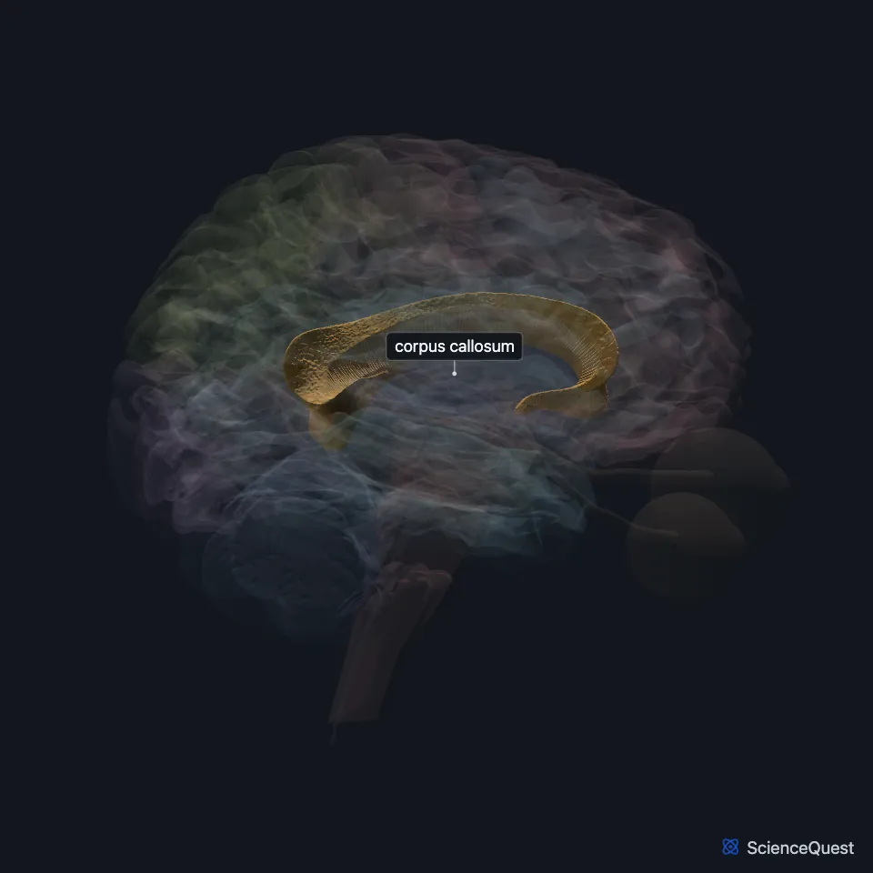 The brain model seen from the right with the cortex faded, showing the corpus callosum highlighted as an arch of white matter between the hemispheres.