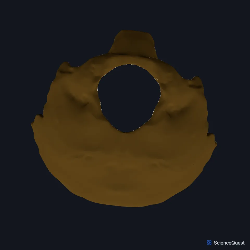 The occipital bone alone, seen from below: the large foramen magnum with an occipital condyle on each side of it.