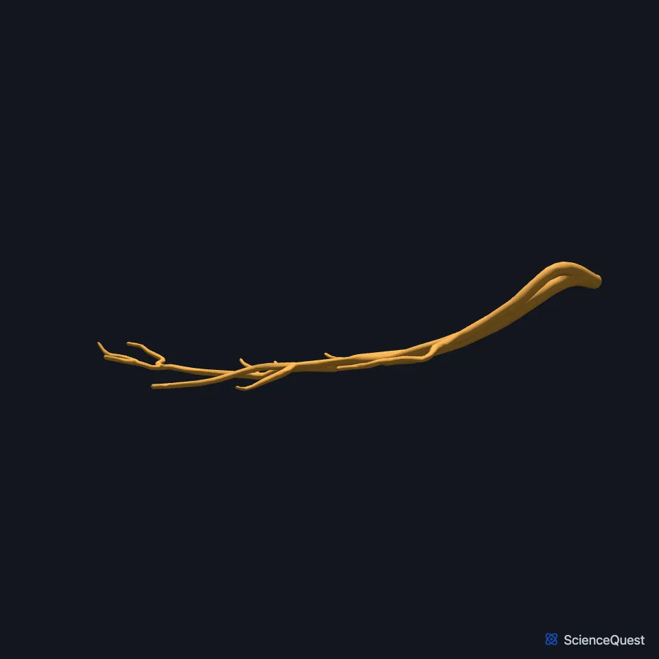 The posterior interventricular artery on its own, seen from behind.