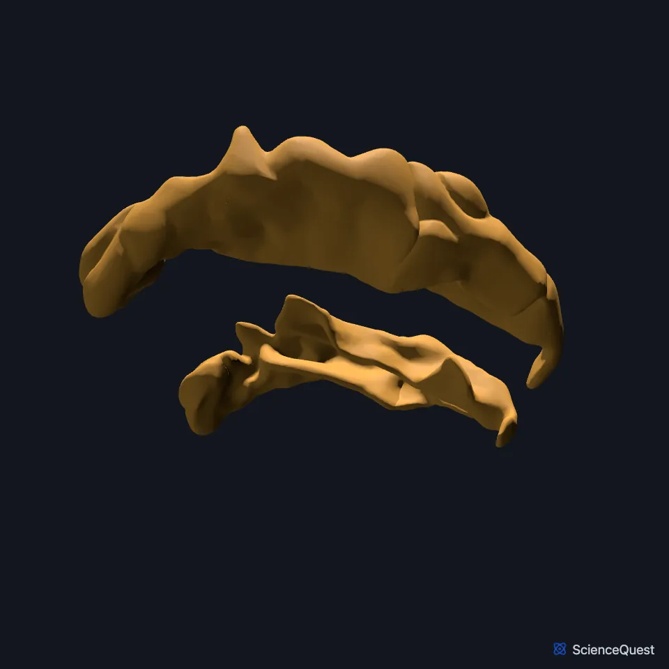 The superior temporal gyrus shown alone and seen from the right, a long gyrus in an anterior and a posterior part.