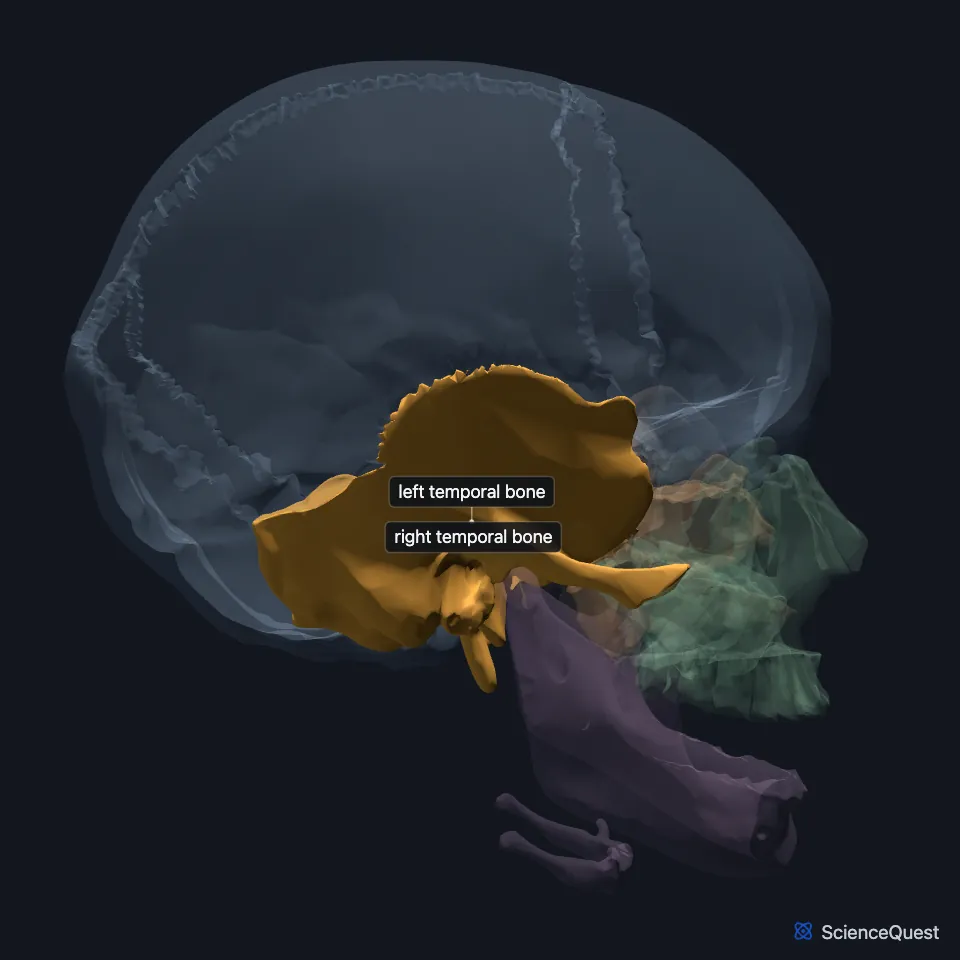 Right side of the skull with the temporal bone highlighted below the parietal bone, around the ear canal, its zygomatic process reaching forward into the back of the zygomatic arch.